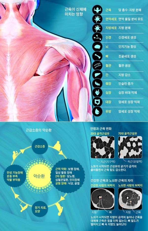 근육은 '에너지 저수지'… 근감소증이 노쇠·전신 질환 부른다